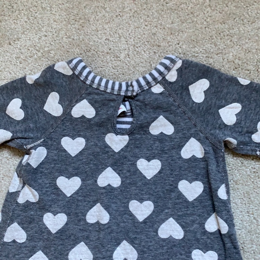 Hanna Andersson Dress Bundle - Picture 6 of 8